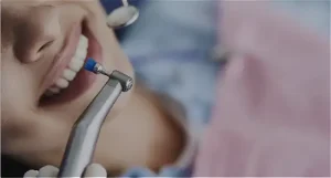 Dental cleaning in Frisco TX