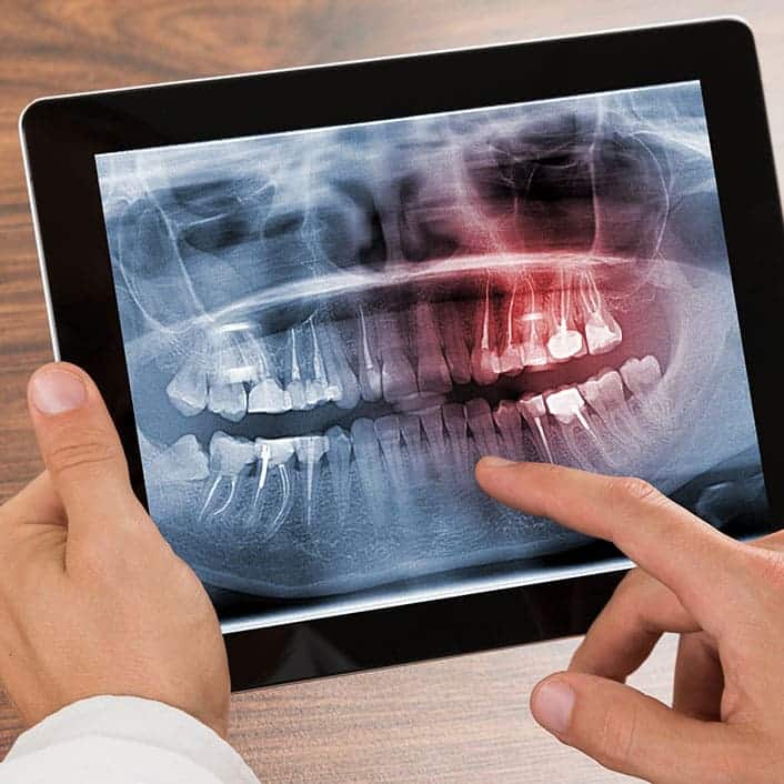 Digital X-rays & Imaging