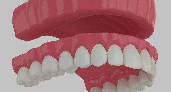 Dentures