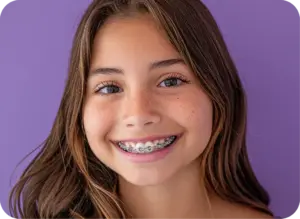 Braces and aligners in Frisco TX